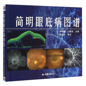 簡明眼底病圖譜 pdf epub mobi 電子書 下載