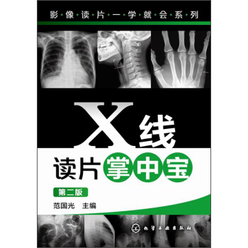 影像讀片一學就會係列：X綫讀片掌中寶（第二版） pdf epub mobi 電子書 下載