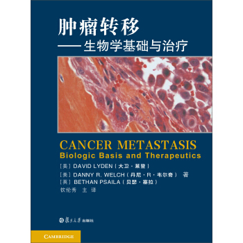 腫瘤轉移：生物學基礎及治療 [Cancer Metastasis Biologic Basis and Therapeutics] pdf epub mobi 電子書 下載