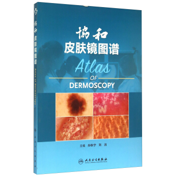 協和皮膚鏡圖譜 [Atlas Of Dermoscopy] pdf epub mobi 電子書 下載