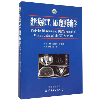 盆腔疾病CT、MRI鑒彆診斷學 [Pelvic Diseases： Differential Diagnosis With CT& MRI] pdf epub mobi 電子書 下載