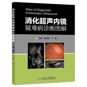 消化超聲內鏡疑難病診斷圖解 pdf epub mobi 電子書 下載