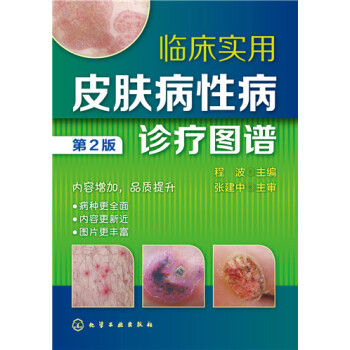 临床实用皮肤病性病诊疗图谱（第2版） pdf epub mobi 电子书 下载