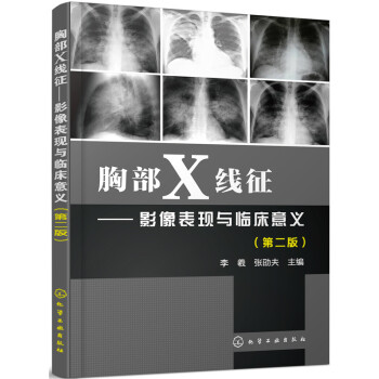 胸部X綫徵 影像錶現與臨床意義（第二版） pdf epub mobi 電子書 下載