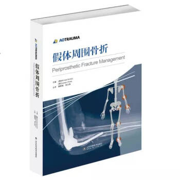 假體周圍骨摺 pdf epub mobi 電子書 下載