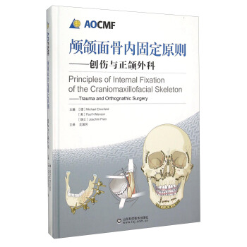 顱頜麵骨內固定原則 創傷與正頜外科 [Principles of Internal Fixation of the Craniomaxillofacial Skeleton：Trauma and Orthognathic Surgery]