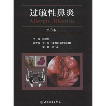 過敏性鼻炎(第2版) pdf epub mobi 電子書 下載