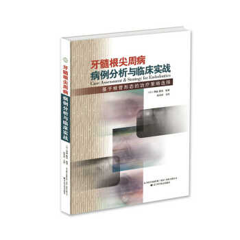 牙髓根尖周病病例分析与临床实战：基于根管形态的治疗疾病策略选择 pdf epub mobi 电子书 下载