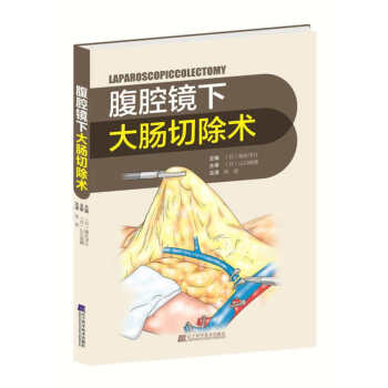 腹腔鏡下大腸切除術 pdf epub mobi 電子書 下載