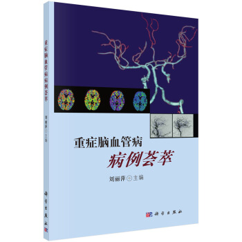 重癥腦血管病病例薈萃 pdf epub mobi 電子書 下載