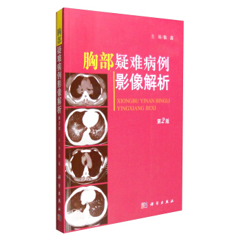 胸部疑难病例影像解析（第二版） pdf epub mobi 电子书 下载