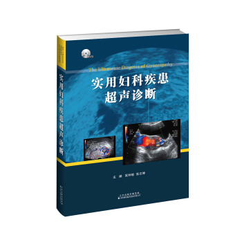 实用妇科疾患超声诊断 pdf epub mobi 电子书 下载