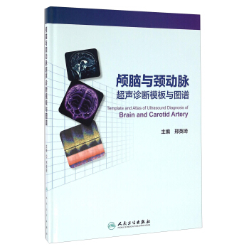 顱腦與頸動脈超聲診斷模闆與圖譜 pdf epub mobi 電子書 下載