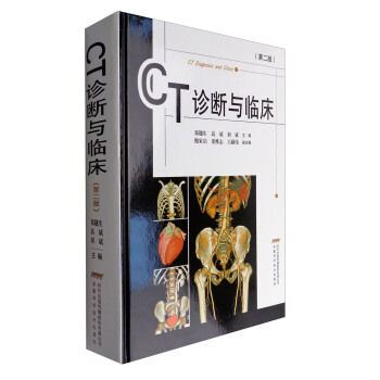 CT诊断与临床（第二版） [CT Diagnosis and Clinic] pdf epub mobi 电子书 下载