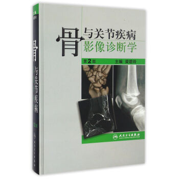 骨与关节疾病影像诊断学（第2版） pdf epub mobi 电子书 下载