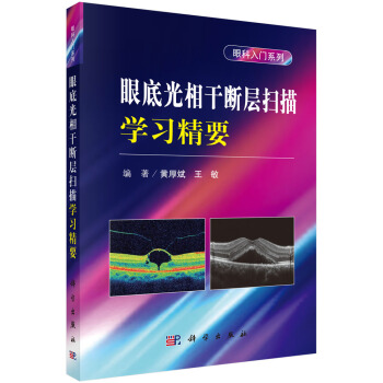 眼底光相干断层扫描学习精要--眼科入门系列 pdf epub mobi 电子书 下载