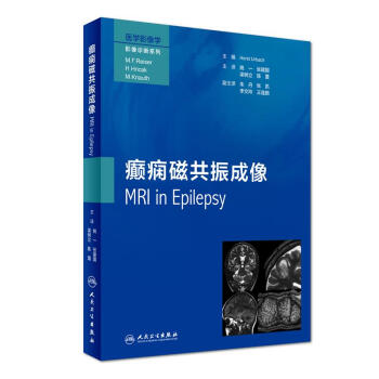 癲癇磁共振成像(翻譯版) pdf epub mobi 電子書 下載