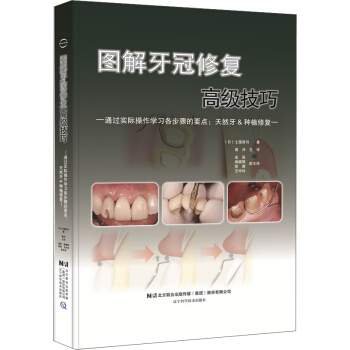 圖解牙冠修復高級技巧