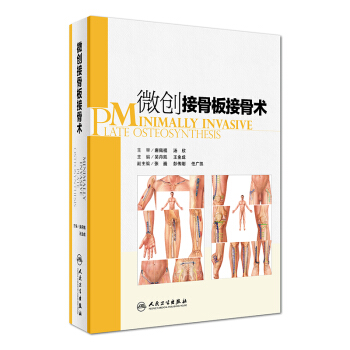 微創接骨闆接骨術