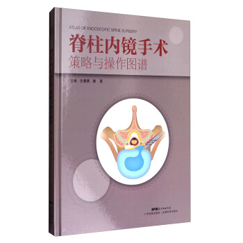 脊柱內鏡手術策略與操作圖譜 [Atlas of Endoscopic Spine Surgery] pdf epub mobi 電子書 下載