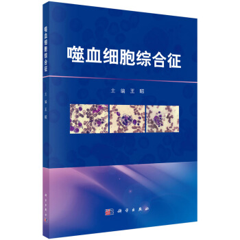 噬血細胞綜閤徵 pdf epub mobi 電子書 下載