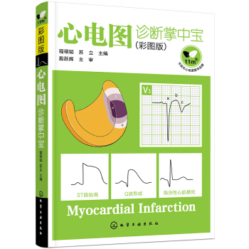 心電圖診斷掌中寶（彩圖版） pdf epub mobi 電子書 下載