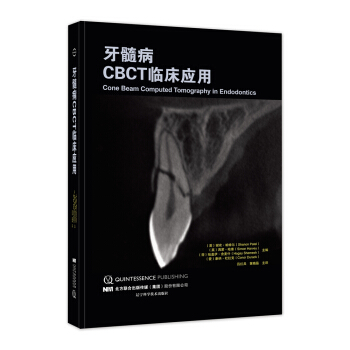 牙髓病CBCT臨床應用