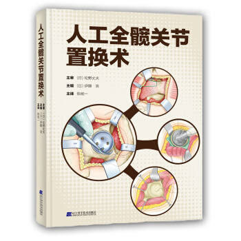 人工全髖關節置換術 pdf epub mobi 電子書 下載