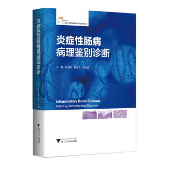 炎癥性腸病病理鑒彆診斷 炎癥性腸病診斷與治療叢書 pdf epub mobi 電子書 下載