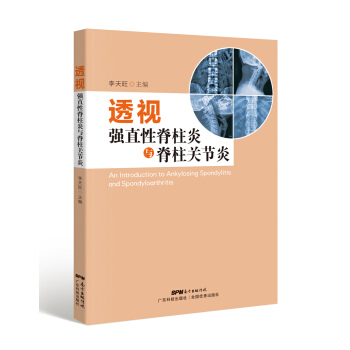透視強直性脊柱炎與脊柱關節炎 pdf epub mobi 電子書 下載