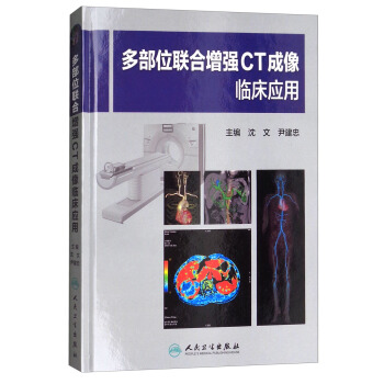 多部位聯閤增強CT成像臨床應用 pdf epub mobi 電子書 下載