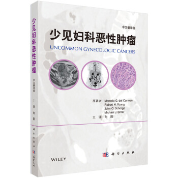 少见妇科恶性肿瘤(中文翻译版)