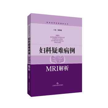 妇科疑难病例MRI解析