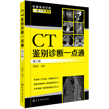 影像鉴别诊断一目了然系列--CT鉴别诊断一点通（第三版） pdf epub mobi 电子书 下载