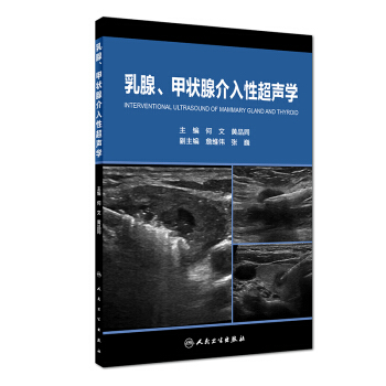 乳腺、甲狀腺介入性超聲學 pdf epub mobi 電子書 下載