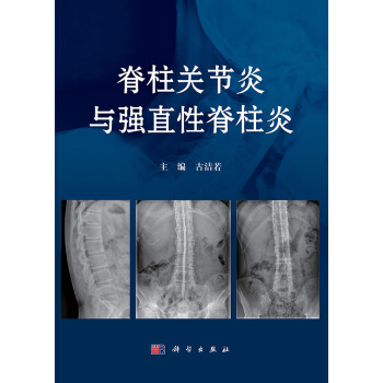 [按需印刷] 脊柱關節炎與強直性脊柱炎 pdf epub mobi 電子書 下載