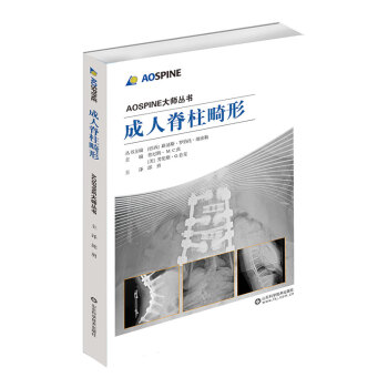 成人脊柱畸形:AOSPINE大師叢書 pdf epub mobi 電子書 下載