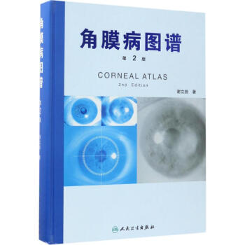 角膜病圖譜(第2版) pdf epub mobi 電子書 下載