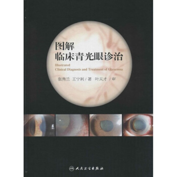 圖解臨床青光眼診治 pdf epub mobi 電子書 下載