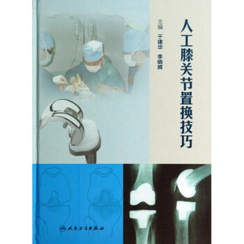 人工膝關節置換技巧(精) pdf epub mobi 電子書 下載