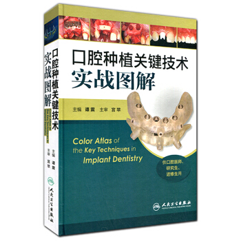 口腔種植關鍵技術實戰圖解（供口腔醫師、研究生、進修生用） pdf epub mobi 電子書 下載