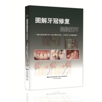 圖解牙冠修復技巧--通過實際操作學習各步驟的要點:天然牙或種植牙(日)土屋賢司著