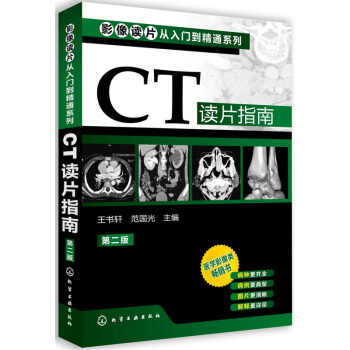 CT讀片指南 (第2版) 影像學醫學類暢銷書 影像解剖學診斷圖譜 影像讀片從入門到精通係列