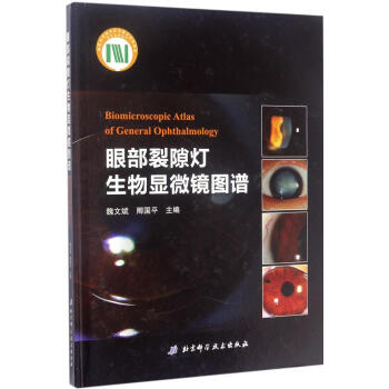 眼部裂隙灯生物显微镜图谱 pdf epub mobi 电子书 下载