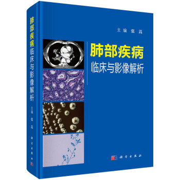 包邮 2018版肺部疾病临床与影像解析 张嵩主编9787030565556肺疾病影像诊断书籍