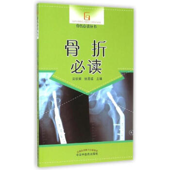 骨折必读 pdf epub mobi 电子书 下载