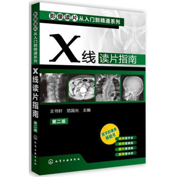 X綫讀片指南(第二版) 影像學醫學類 影像解剖學診斷圖譜 影像讀片從入門到精通X綫讀片指南