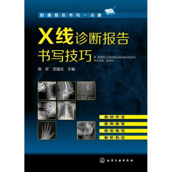 X綫診斷報告書寫技巧 pdf epub mobi 電子書 下載