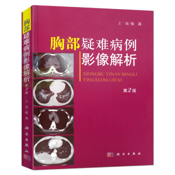 胸部疑难病例影像解析 第2版 张嵩 pdf epub mobi 电子书 下载