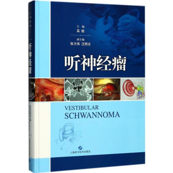 听神经瘤 pdf epub mobi 电子书 下载